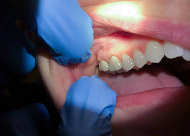 Best Emergency Treatment for Jaw Pain or Injury in Lincoln, AL